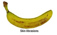 Disorders Photos Banana Skin Abrasions