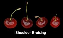 Shoulder Bruising